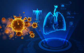 AI help diagnose coronavirus pneumonia