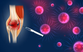 ligan-conjugate nanoparticle treat oseoarthritis