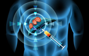 ionic liquid to ablate liver tumours