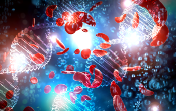 CRISPOR editing to treat sickle cell disease