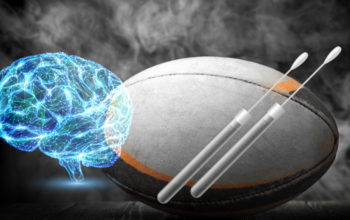 biomarkers in saliva diagnoses concussion