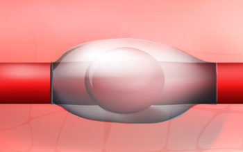self-healing elastomers to replace sutures