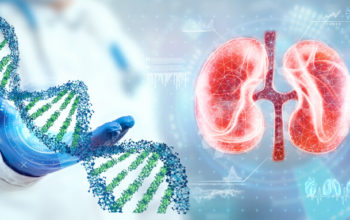 genetically modified pig kidney transplanted into human